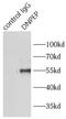 Aspartyl Aminopeptidase antibody, FNab02487, FineTest, Immunoprecipitation image 