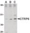 C1q And TNF Related 6 antibody, NBP1-03121, Novus Biologicals, Western Blot image 