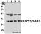 COP9 Signalosome Subunit 5 antibody, A01849, Boster Biological Technology, Western Blot image 