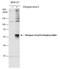 Dengue virus antibody, GTX127277, GeneTex, Western Blot image 