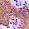 Cortactin antibody, LS-C353974, Lifespan Biosciences, Immunohistochemistry paraffin image 