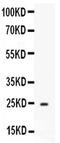Apolipoprotein A1 antibody, PA5-78798, Invitrogen Antibodies, Western Blot image 