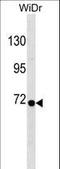 Ribophorin I antibody, LS-C162723, Lifespan Biosciences, Western Blot image 