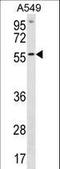 ETS Variant 5 antibody, LS-C157732, Lifespan Biosciences, Western Blot image 