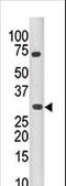 Pim-3 Proto-Oncogene, Serine/Threonine Kinase antibody, LS-B3461, Lifespan Biosciences, Western Blot image 