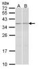 TGFB Induced Factor Homeobox 2 antibody, LS-C185943, Lifespan Biosciences, Western Blot image 
