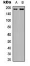 Insulin Receptor Substrate 1 antibody, LS-C368391, Lifespan Biosciences, Western Blot image 