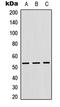 Cathepsin F antibody, LS-C354302, Lifespan Biosciences, Western Blot image 