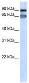 Mediator Complex Subunit 16 antibody, TA344539, Origene, Western Blot image 