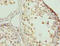 Zinc Finger Protein 131 antibody, orb26431, Biorbyt, Immunohistochemistry paraffin image 