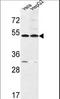 Fermitin family homolog 1 antibody, LS-B9898, Lifespan Biosciences, Western Blot image 