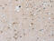 Pentraxin-related protein PTX3 antibody, CSB-PA441852, Cusabio, Immunohistochemistry paraffin image 