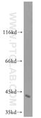 Mitochondrially Encoded NADH:Ubiquinone Oxidoreductase Core Subunit 2 antibody, 19704-1-AP, Proteintech Group, Western Blot image 