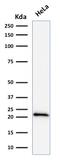 p21 antibody, GTX34927, GeneTex, Western Blot image 