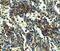 PYD And CARD Domain Containing antibody, A00362, Boster Biological Technology, Immunohistochemistry paraffin image 