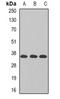 TAM41 Mitochondrial Translocator Assembly And Maintenance Homolog antibody, orb382069, Biorbyt, Western Blot image 