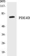Phosphodiesterase 4D antibody, EKC1446, Boster Biological Technology, Western Blot image 
