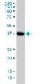 N-Acetylneuraminate Synthase antibody, H00054187-M01, Novus Biologicals, Western Blot image 