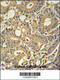 Tryptase Delta 1 antibody, 55-222, ProSci, Immunohistochemistry paraffin image 