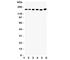 Transient Receptor Potential Cation Channel Subfamily M Member 2 antibody, R31355, NSJ Bioreagents, Western Blot image 