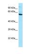 Interleukin 2 Receptor Subunit Beta antibody, orb331125, Biorbyt, Western Blot image 