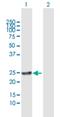 RAB22A, Member RAS Oncogene Family antibody, H00057403-B01P, Novus Biologicals, Western Blot image 