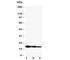 Interleukin 1 Beta antibody, R30418, NSJ Bioreagents, Western Blot image 