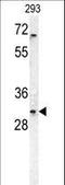 Tumor necrosis factor receptor superfamily member 6B antibody, LS-C162068, Lifespan Biosciences, Western Blot image 