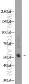 Transmembrane Serine Protease 5 antibody, 24616-1-AP, Proteintech Group, Western Blot image 