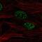 SMAD Specific E3 Ubiquitin Protein Ligase 2 antibody, NBP2-57554, Novus Biologicals, Immunofluorescence image 
