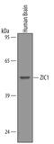 Zic Family Member 1 antibody, PA5-47681, Invitrogen Antibodies, Western Blot image 