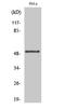 Glycogen Synthase Kinase 3 Alpha antibody, STJ90282, St John