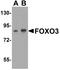 Forkhead Box O3 antibody, A00252, Boster Biological Technology, Western Blot image 