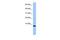 Spermatid nuclear transition protein 1 antibody, GTX45488, GeneTex, Western Blot image 