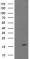 TPD52 Like 3 antibody, NBP2-03778, Novus Biologicals, Western Blot image 