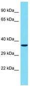 Thymus, Brain And Testes Associated antibody, TA331620, Origene, Western Blot image 