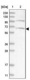 Armadillo Repeat Containing 8 antibody, NBP1-85149, Novus Biologicals, Western Blot image 