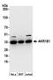 Aldose reductase antibody, A305-307A, Bethyl Labs, Western Blot image 