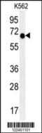 Integrin Subunit Beta 6 antibody, LS-C165328, Lifespan Biosciences, Western Blot image 