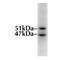 Glycogen Synthase Kinase 3 Beta antibody, MA1-7621, Invitrogen Antibodies, Western Blot image 