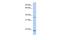 Sprouty RTK Signaling Antagonist 2 antibody, PA5-43584, Invitrogen Antibodies, Western Blot image 