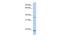 Sprouty RTK Signaling Antagonist 2 antibody, PA5-43584, Invitrogen Antibodies, Western Blot image 