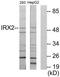 Iroquois Homeobox 2 antibody, TA316173, Origene, Western Blot image 