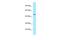 Ubiquinol-Cytochrome C Reductase Core Protein 2 antibody, A07937, Boster Biological Technology, Western Blot image 