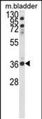 Coiled-Coil Domain Containing 3 antibody, PA5-49634, Invitrogen Antibodies, Western Blot image 