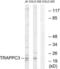 Trafficking Protein Particle Complex 3 antibody, LS-C120429, Lifespan Biosciences, Western Blot image 