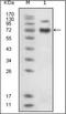 EPH Receptor B4 antibody, orb89263, Biorbyt, Western Blot image 