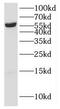 Q92993-3 antibody, FNab04468, FineTest, Western Blot image 