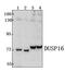 Dual Specificity Phosphatase 16 antibody, PA5-75967, Invitrogen Antibodies, Western Blot image 