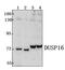 Dual specificity protein phosphatase 16 antibody, PA5-75967, Invitrogen Antibodies, Western Blot image 